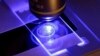 Las investigaciones microbiológicas han permitido a los científicos determinar los rangos de proliferación de los hongos y las enfermedades que causan, la resistencia a medicamentos causa preocupación por lo que la OMS ha focalizado atención en grupos. (Foto ilustrativa AP)