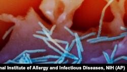 This image from the National Institutes of Health shows human respiratory syncytial virus (RSV) virions, colorized blue, and anti-RSV F protein/gold antibodies, colorized yellow. (National Institute of Allergy and Infectious Diseases, NIH via AP)