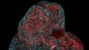 Scientists Grow Mini-Organs in Cells from Pregnancy Fluid