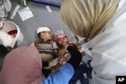 Arhiva - Palestinska deca ranjena u izraelskom bombardovanju Pojasa Gaze bivaju zbrinuta u bolnici Al Aksa, u Deir al Balahu, 9. juna 2024.