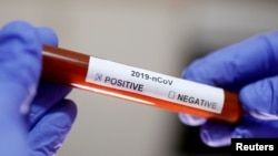 Epruveta sa testom na koronavirus