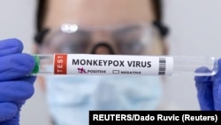 资料照片：显示猴痘病毒呈阳性的试管。（2022年5月23日）
