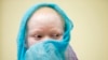 Moçambique preocupado com o rapto de albinos