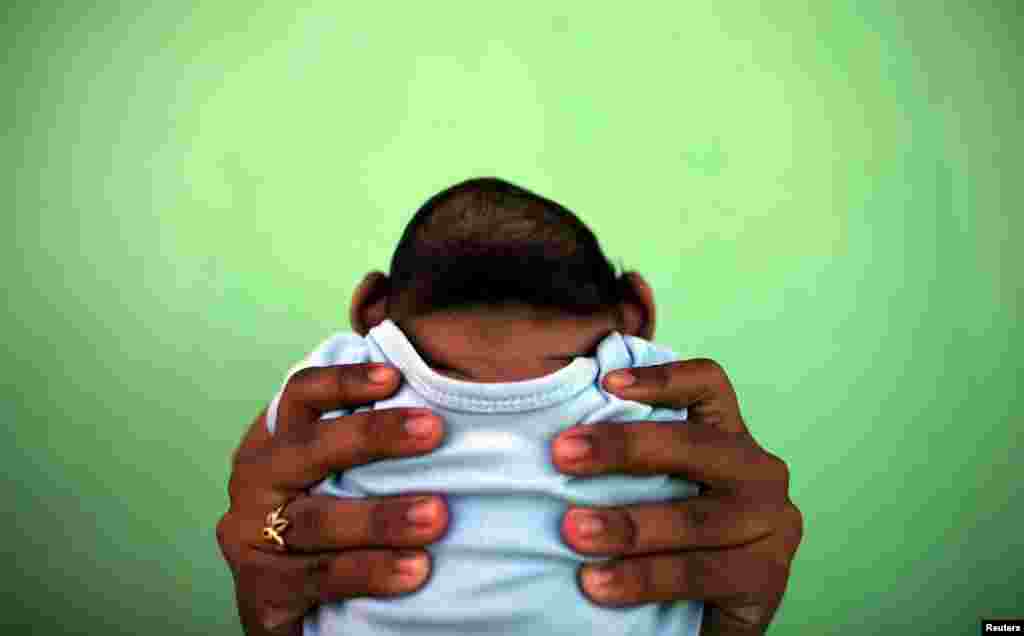 A 4-month-old baby born with microcephaly is held by his mother in front of their house in Olinda, near Recife, Brazil, Feb. 11, 2016.