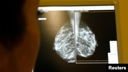 FILE - Dr. Mary-Claire King, one of this year's five winners of the so-called ‘American Nobels’ in medicine, says every woman over the age of 30 needs to be tested for cancer-causing genetic mutations.