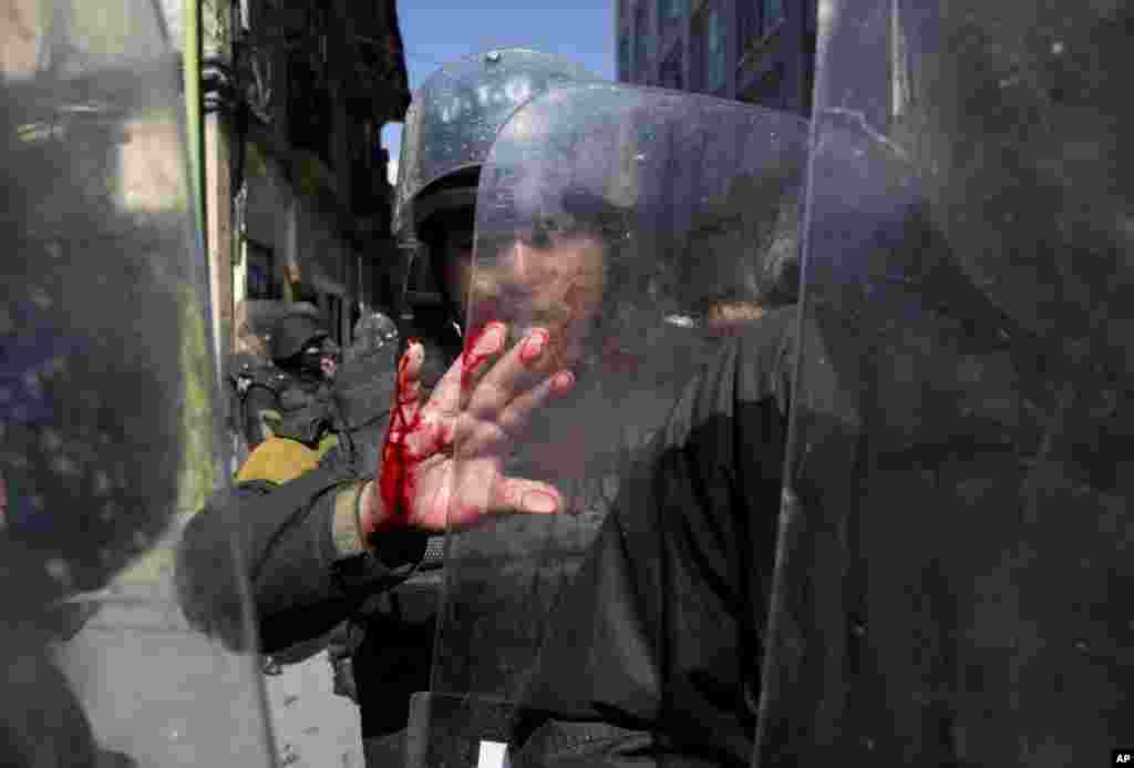 A police officer's hand is bloodied as he blocks protesters with disabilities from reaching Plaza Murillo in La Paz, Bolivia, May 25, 2016. Protesters marched to the National Palace to demand an increase in government disability compensation.