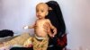 WFP to Resume Food Aid to Yemenis in Houthi-Controlled Area 