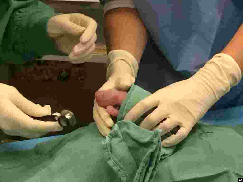 In this photo provided by the Smithsonian National Zoo, one of the giant panda cubs is examined by veterinarians after being born at the zoo on Aug. 22, 2015, in Washington. (Pamela Baker-Masson/Smithsonian's National Zoo)