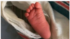 Dalam kurun waktu dua tahun, sedikitnya ada enam bayi yang terlahir tidak normal di Mandailing Natal. Bayi-bayi itu diduga terpapar zat kimia berbahaya seperti merkuri pada saat masih janin. (Foto: ilustrasi).