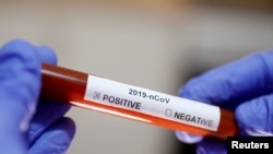 Los casos de coronavirus confirmados este viernes por México son el segundo y tercero en América Latina.