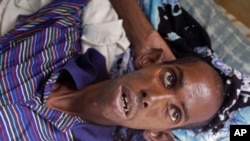 A malnourished refugee from Somalia at a field hospital of the International Rescue Committee, IRC, in Dadaab, Kenya, Wednesday, Aug. 3, 2011.