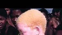 Albinos continuam com medo, mas número de ataques caiu em Nampula