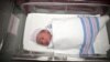 Study: C-Section Babies Face High Obesity Risk