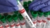 Vaccine doses allocated for 9 African countries hardest hit by mpox