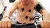 Corazón viejo en cuerpo más joven