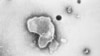 Data Shows RSV Vaccine Given to Pregnant Women Protects Newborns