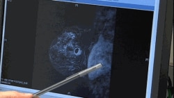 Patients reporting greater stress were more likely to have more aggressive breast cancer tumors, according to a new study.