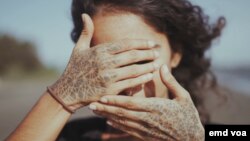 “Niñas y mujeres (son) los principales blancos de la trata de personas”, según las Naciones Unidas. 