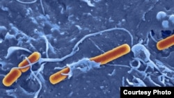 Shigella Sonsei bacterium (photo by David Goulding, Wellcome Trust Sanger Institute)