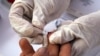 CDC: US HIV Diagnoses Improving, But Progress Varies