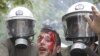 Rough Road Ahead for Greece Despite Austerity Measures