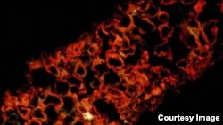This is a micrograph of a tobacco leaf (N. benthamiana) with the Ebola monoclonal fluorescently labeled within the plant cells. (Dr. Jeffrey Pudney, Boston University)