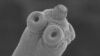 Man's Life Saved After Tapeworm Removed from Brain