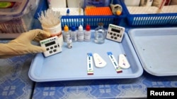 FILE - HIV tests show negative and positive results.