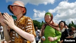 Célébrations de la journée des albinos de Tanzanie à Dar es Salaam, janvier 2015. 