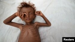 A malnourished boy lies on a bed outside his family's hut in al-Tuhaita district of the Red Sea province of Hudaydah, Yemen, Sept. 26, 2016.
