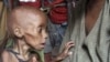 Food Aid Reaches Famine-Stricken Somalia