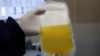 Terapi plasma konvalesen, donor plasma dari penyintas Covid-19 ditengarai menjanjikan penyembuhan bagi penderita virus tersebut. (Foto: AP)
