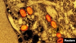 FILE - Colorized transmission electron micrograph of mpox virus particles captured at the NIAID Integrated Research Facility in Fort Detrick. Thailand has detected an mpox case in a European man who arrived from Africa last week.