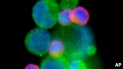 In this new study, the researchers tested the urine of prostate patients for TMPRSS2:ERG plus PCA3, another genetic marker associated with prostate cancer.
