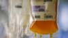 Plasma convaleciente para tratar COVID-19: claves para entender por qué los médicos defienden su uso