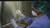 Obat Transplantasi Mungkin Bisa Atasi HIV