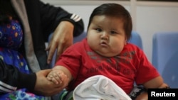 កុមារ​អាយុ​ប្រាំបី​ខែ​ Santiago Mendoza អង្គុយ​នៅ​ក្នុង​គ្លីនិក​មួយ​ដែល​ព្យាបាល​មនុស្ស​ធាត់​លើស​ទម្ងន់​ក្នុង​ទីក្រុង​ Bogota កាលពី​ថ្ងៃទី​១៩ មិនា ២០១៤។