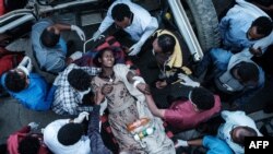 Mkazi wa Togoga, aliyejeruhiwa kufuatia shambulizi la anga lililofanywa na Jeshi la Ethiopia huko Mekele akiepelekwa hospitali, Mekele mji mkuu wa Mkoa wa Tigray, Ethiopia, Juni 23, 2021.(Photo by Yasuyoshi CHIBA / AFP)