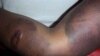 Zimbabwe Torture