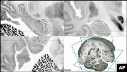 FILE - A highly-detailed image of the hippocampus region of the human brain.